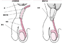 疾病简介