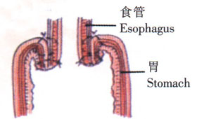 概述