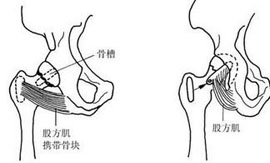 概述