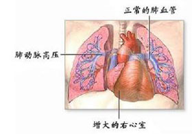 概述