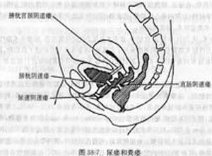 概述