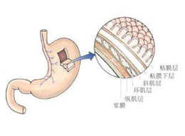 概述