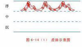 概述