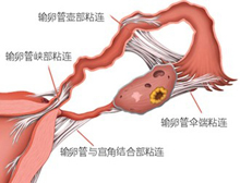 症状描述