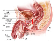 精囊囊肿