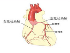 冠状动脉粥样硬化性心脏病的日常保健