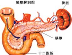 胰腺炎