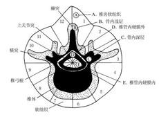 概述