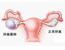 鉴别诊断