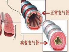 实验检查