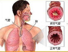 饮食注意