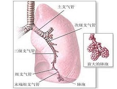 发病原因