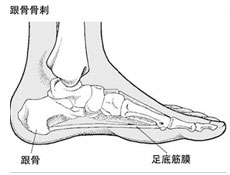 手外伤表现