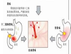 食疗药膳