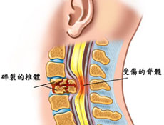 治疗