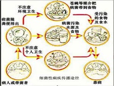 细菌性痢疾
