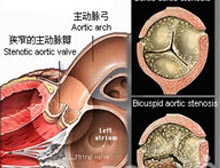 症状起因