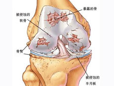 并发症