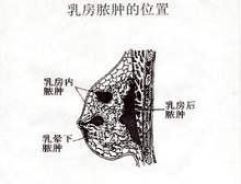 症状起因