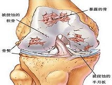 疾病预后
