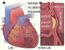 临床表现