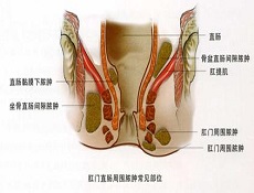 关于关于肛肠科疾病护理的的本科毕业论文范文