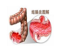 吃什么好