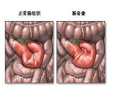 治疗