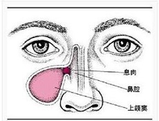 临床分类