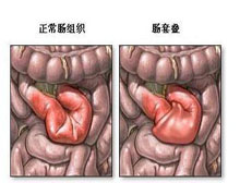 症状描述