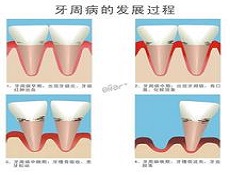 治疗用药