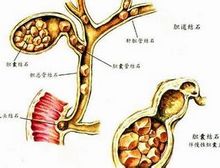 症状描述