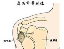 症状起因