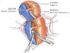 根治术