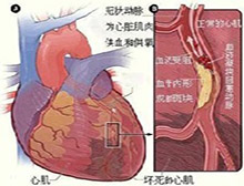 症状描述