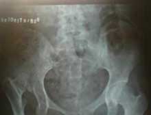 症状起因