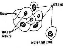 症状描述