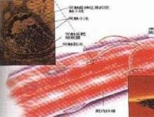 症状描述
