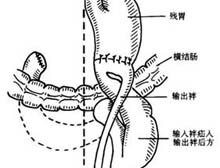 症状起因