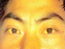 症状起因