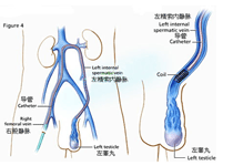 高发人群