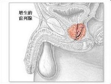 疾病分类