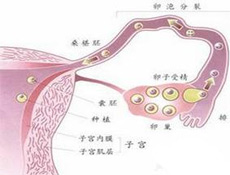 输卵管性不孕