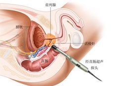 辅助检查