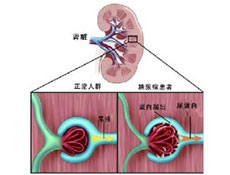 临床表现