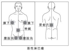 复后治疗