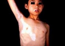 病因病理
