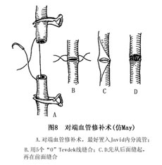 治疗手段