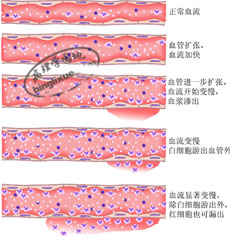 血流动力学反应