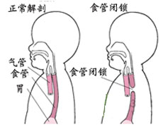 治疗范围